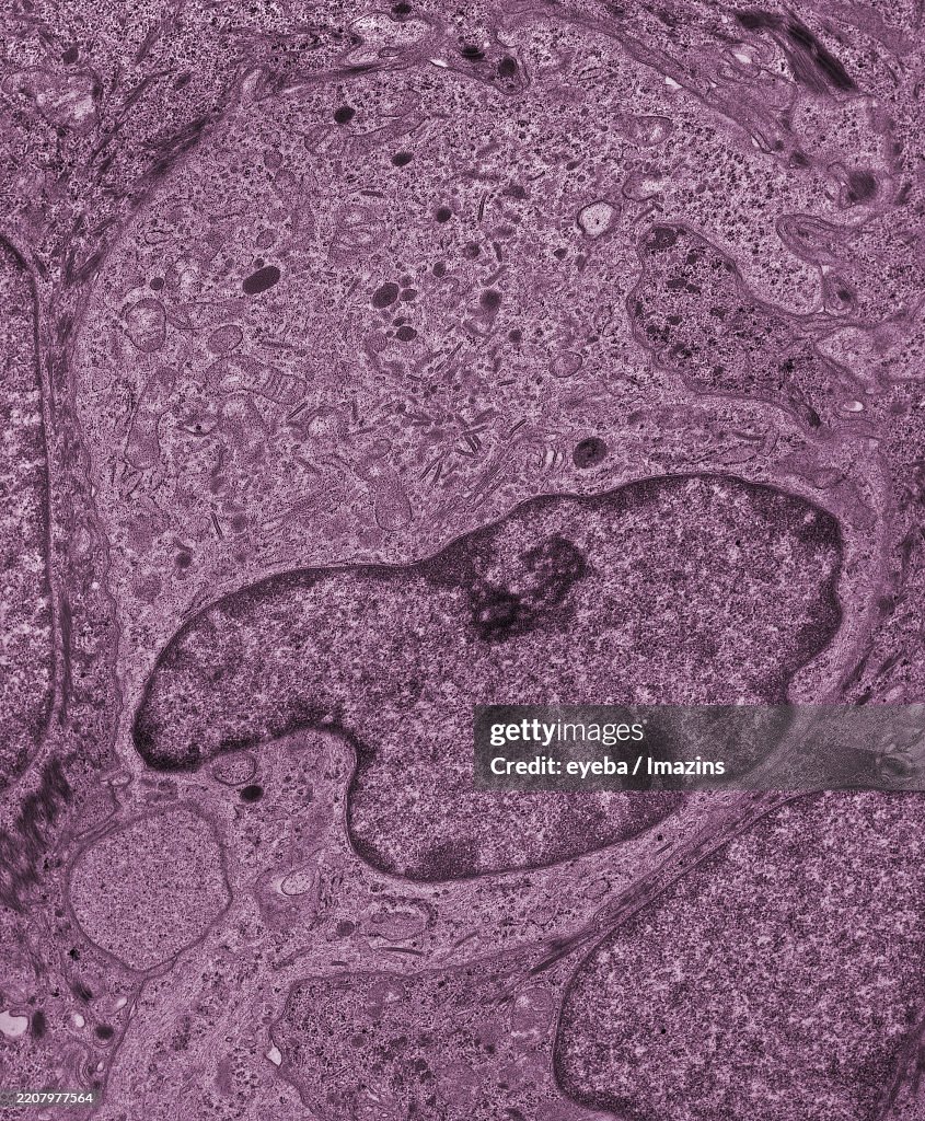 Birbeck body, Birbeck granule, histiocyte, skin, macrophage, immunity, TEM