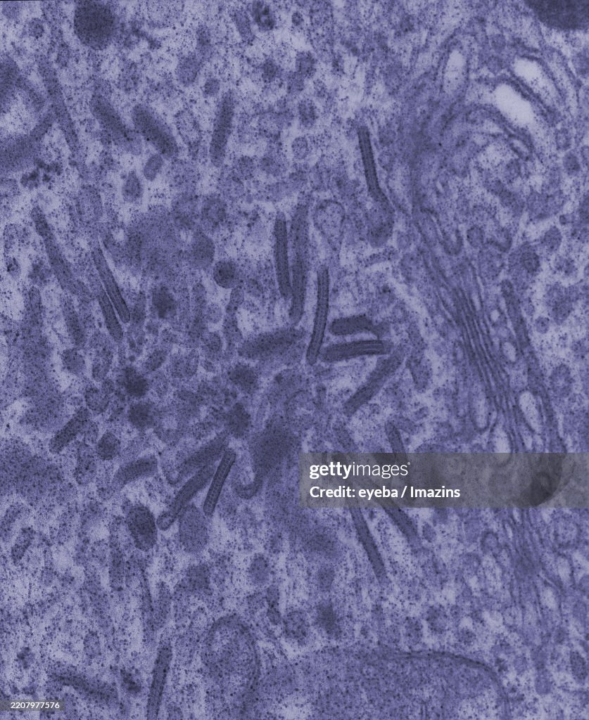 Birbeck body, Birbeck granule, histiocyte, skin, macrophage, immunity, TEM
