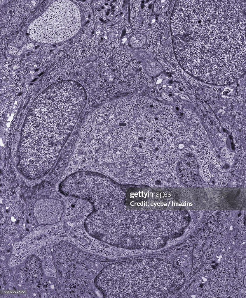 Birbeck body, Birbeck granule, histiocyte, skin, macrophage, immunity, TEM