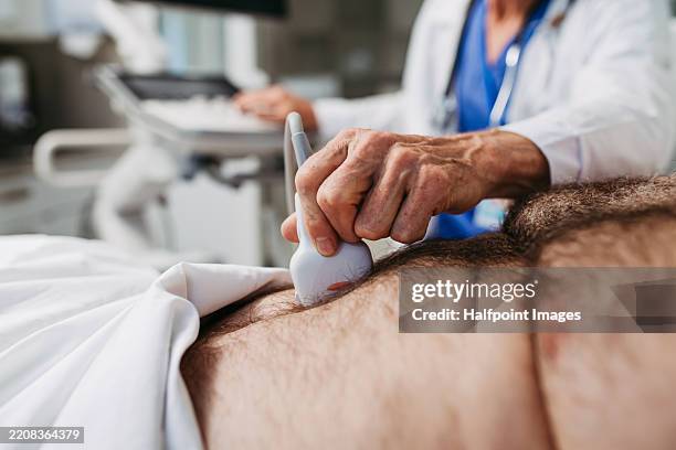 close up of doctor performing an ultrasound on male patient's abdomen - apendicite imagens e fotografias de stock