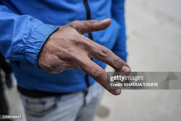 Dub Hand 59 Operation Iron Hand Stock Photos, High-Res Pictures, and Images ...