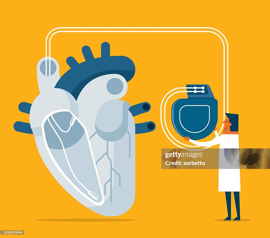 Heart Pacemaker Male Doctor High-Res Vector Graphic - Getty Images