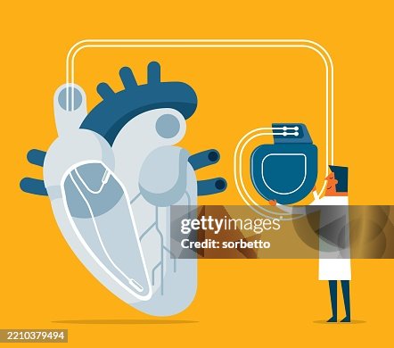Fun Pacemaker Background Heart Pacemaker Male Doctor High-Res Vector Graphic - Getty Images