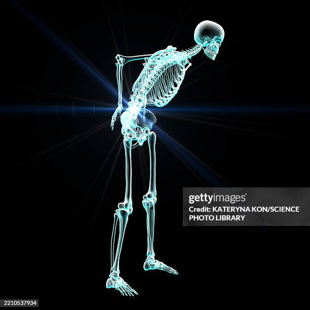 Back Problems Skeleton 5,469 Human Skeleton System Stock Photos, High-Res Pictures, and Images ...