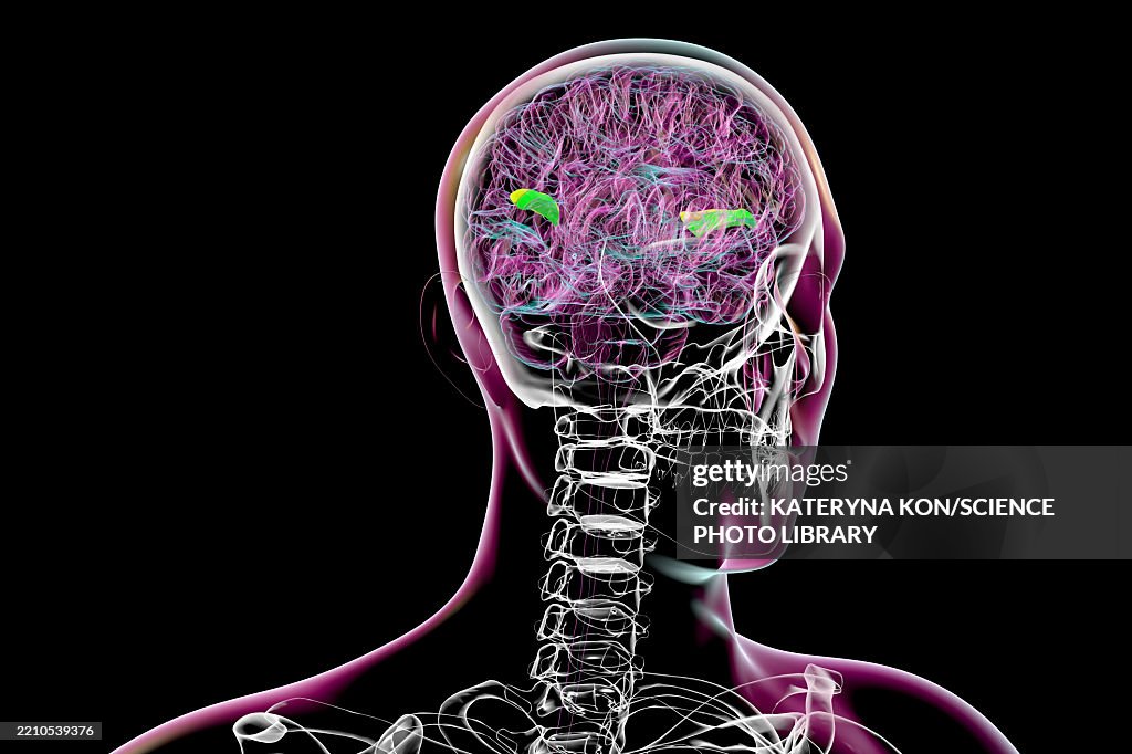Gyri Simple Transverse Temporal Gyri Illustration High-Res Vector Graphic - Getty ...