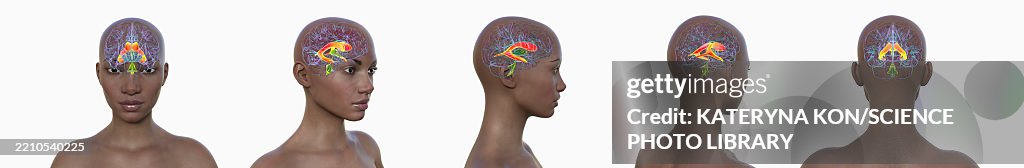 Lateral brain ventricles, illustration