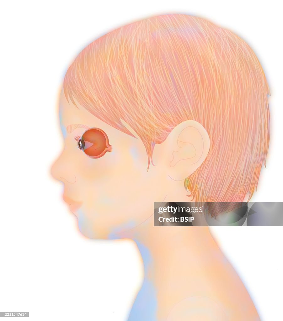 Anatomy, eye