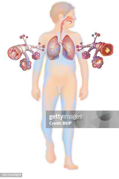 asthma, drawing - copd senior stock illustrations