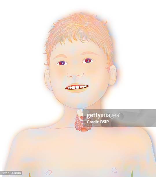 thyroid, illustration - thyroid cartilage stock illustrations
