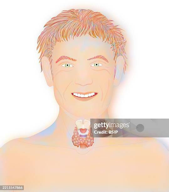 thyroid, illustration - thyroid cartilage stock illustrations
