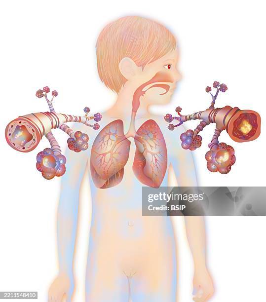 asthma, drawing - copd stock illustrations