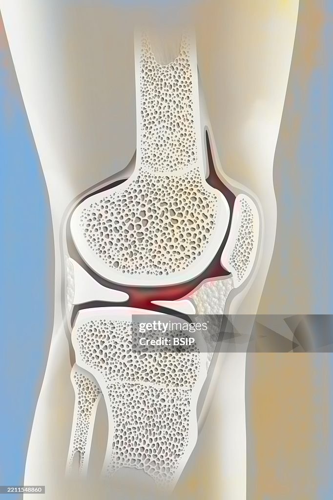 Knee drawing