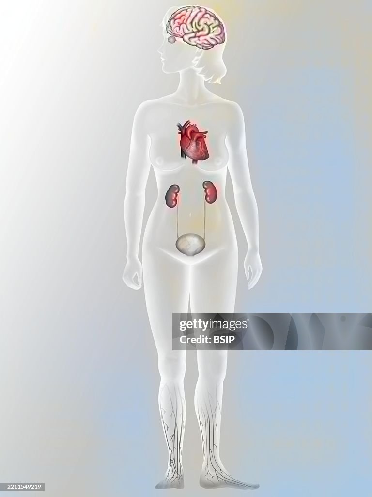 Complications of diabetes