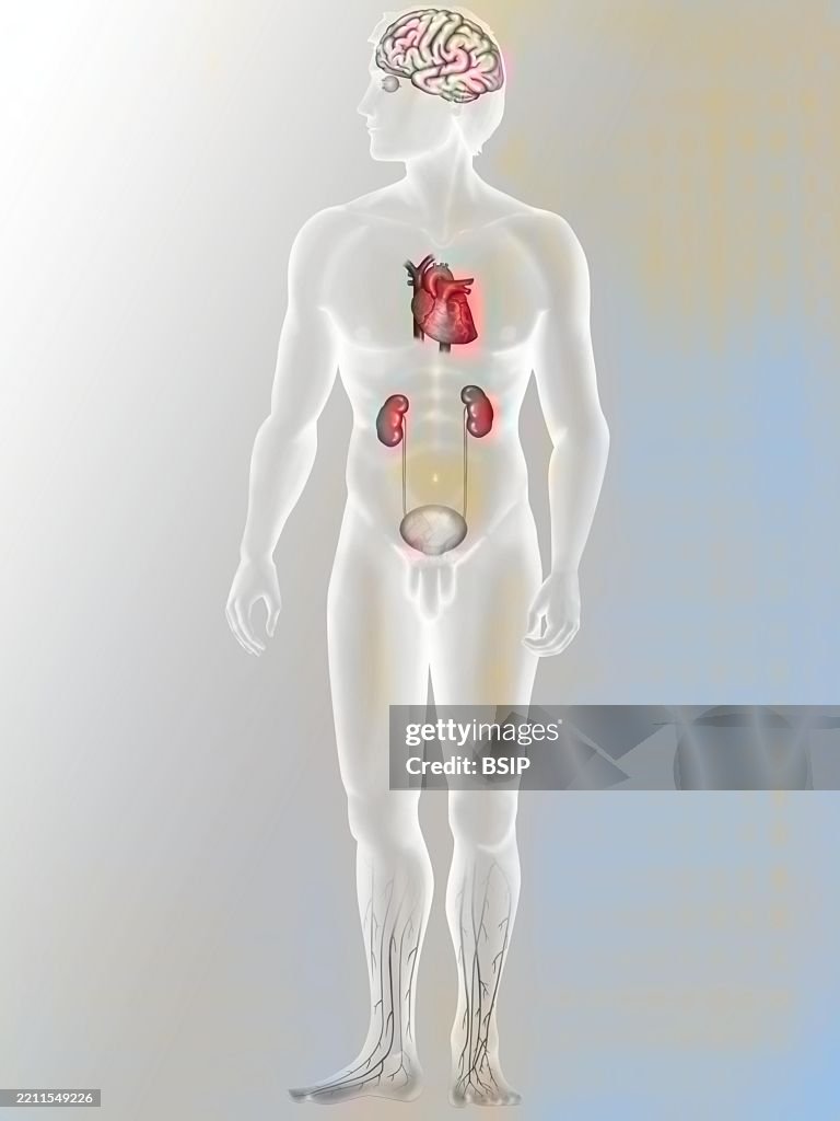 Complications of diabetes