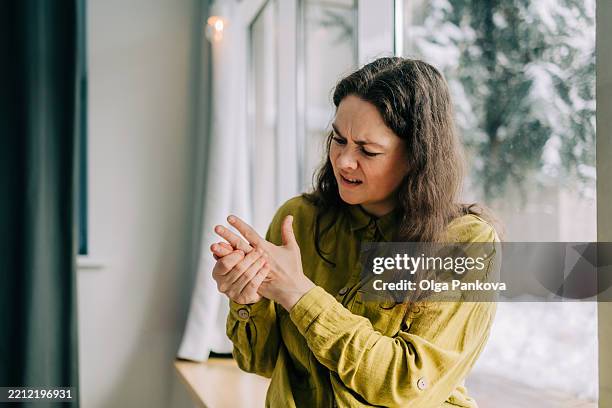 woman feeling strong pain in her hands and massaging them - gelenkrheumatismus stock-fotos und bilder