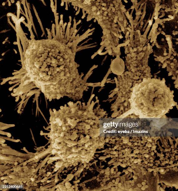 mycoplasma, mycoplasma, pneumonia, cell culture, infection, contamination, pneumonia, cell culture, sem, microscope, cell communication, mycoplasma infection, cell communication, - cultured cell stock pictures, royalty-free photos & images