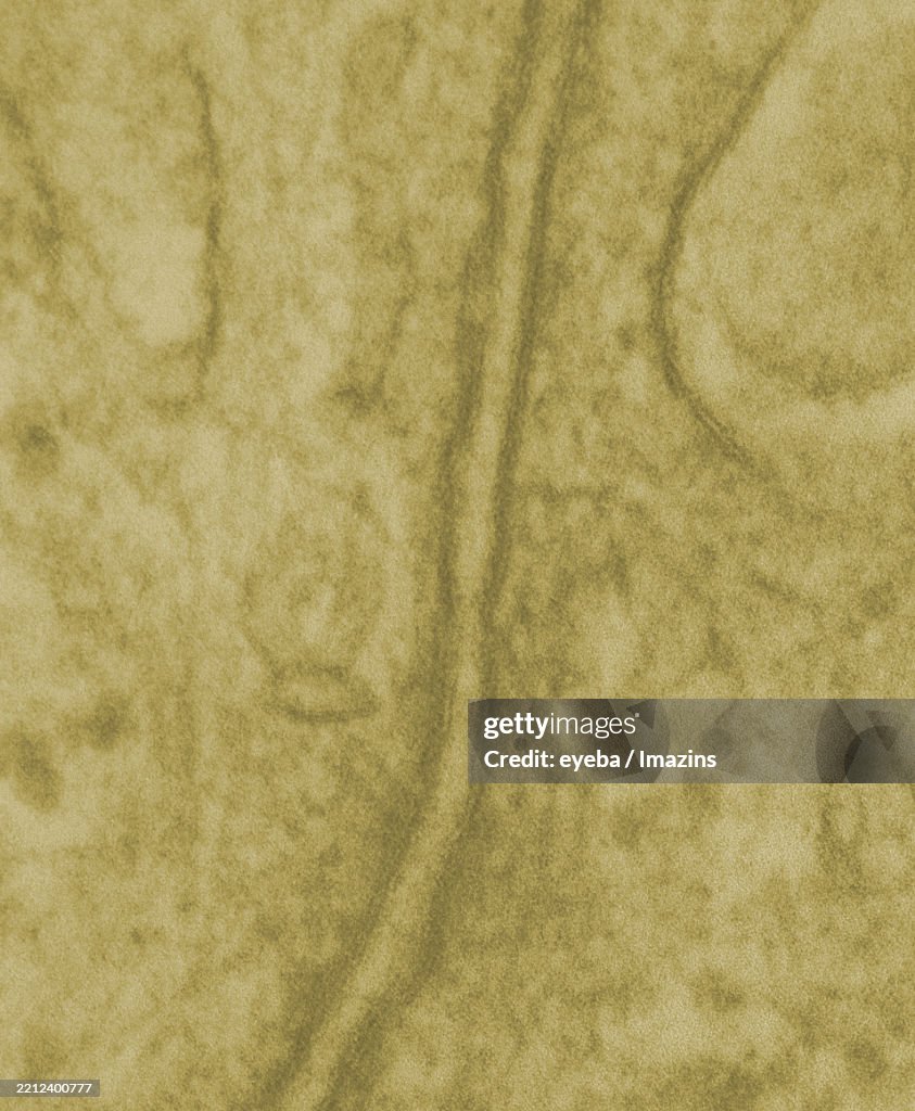 Cytoplasmic membrane, double membrane, phospholipid membrane, cell double membrane, cytoplasmic double membrane, bilayer membrane, lipid bilayer, phospholipid bilayer, TEM, electron microscope