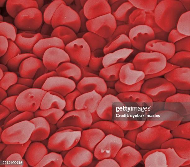 Microscope Image Old Rbc 435 Red Blood Cell Micrograph Stock Photos, High-Res Pictures, and ...