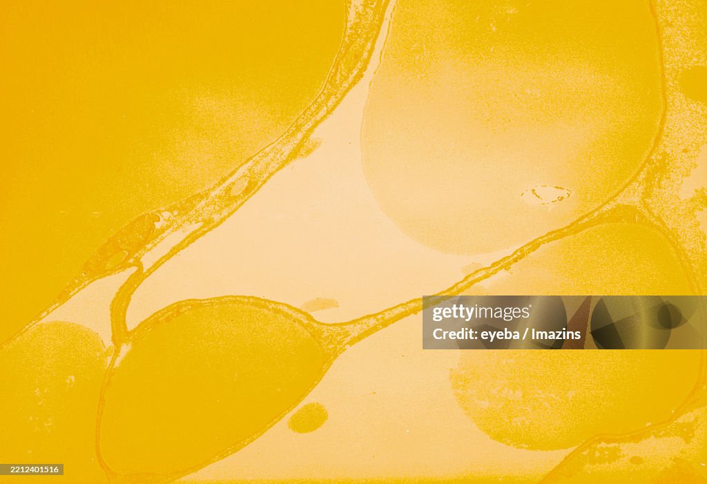 Fat cell, electron microscope, TEM, microscope, Fat cell