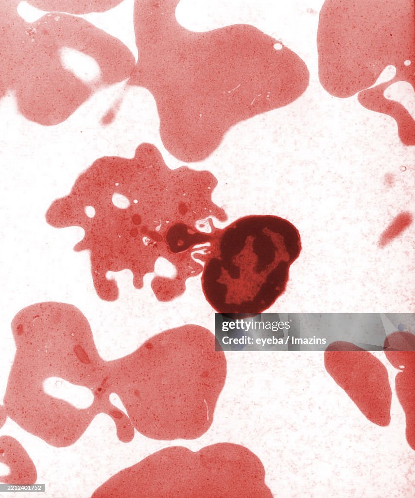 Imtamure Rbc Enucleated Red Blood Cells Red Blood Cells Electron Microscope Tem ...
