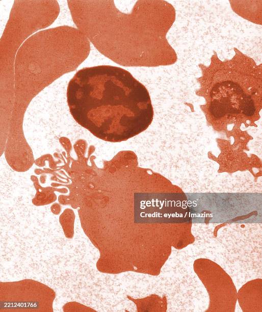 Microscope Image Old Rbc Enucleated Red Blood Cells Red Blood Cells Electron Microscope Tem ...