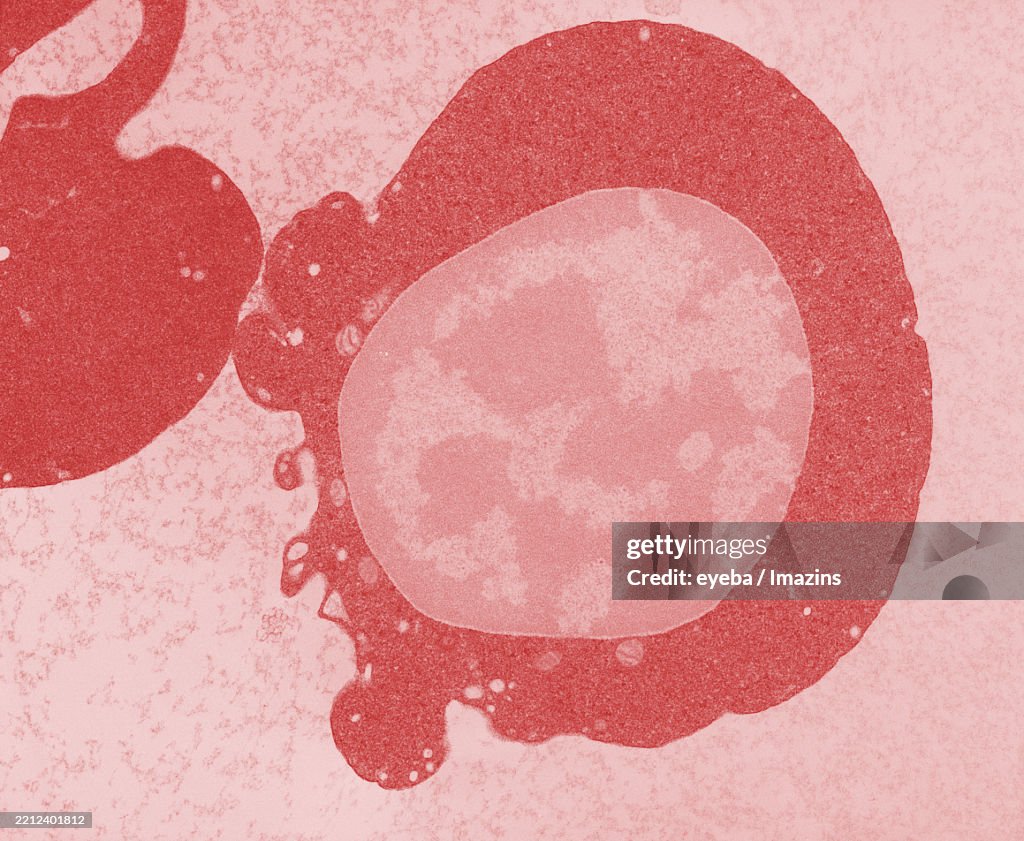 Microscope Image Old Rbc Enucleated Red Blood Cells Red Blood Cells Electron Microscope Tem ...