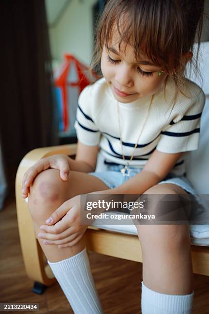 pies de niños con lesiones y arañazos. niño con lesiones en las rodillas y heridas en casa - cardenal lesión física fotografías e imágenes de stock