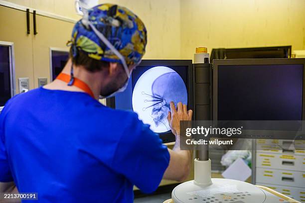 doctor examining medical scan during an eye brachytherapy procedure - thyroid cancer stock pictures, royalty-free photos & images