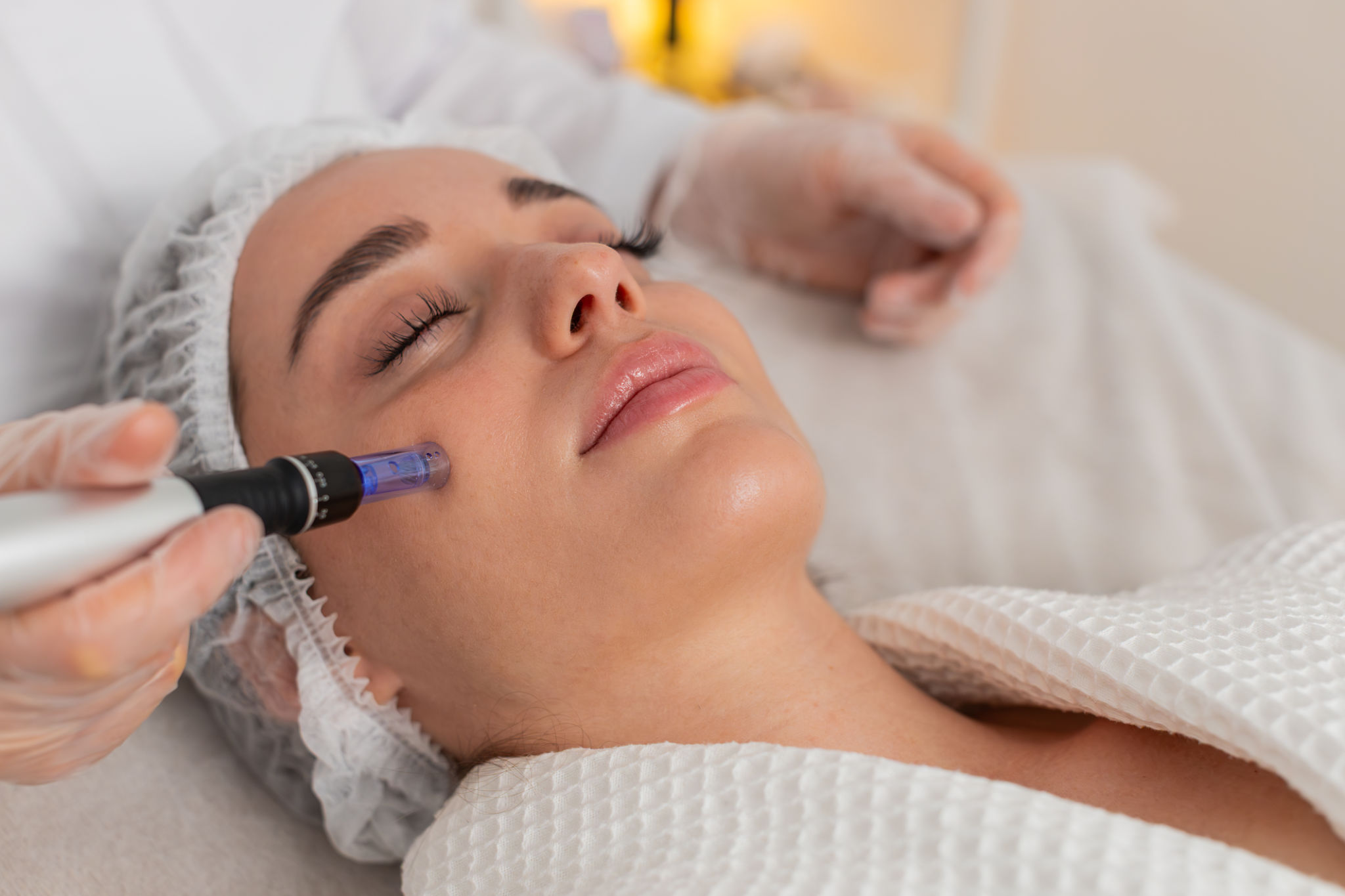 skin rejuvenation