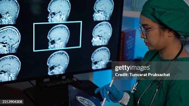 female surgeon looks at screen with mri scan with brain images - hirntumor stock-fotos und bilder