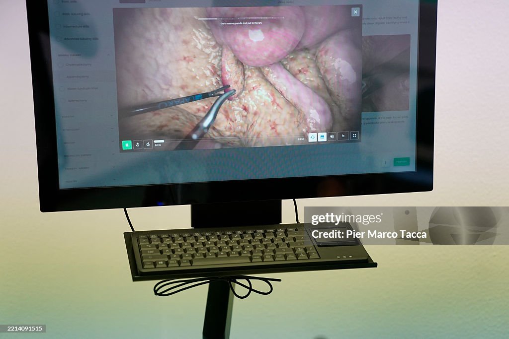 Appendix Train A view of an appendicitis during train with a laparoscopic simulator ...