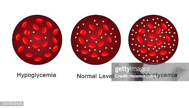 comparison of low, normal and high blood sugar levels - carbohydrate biological molecule stock illustrations