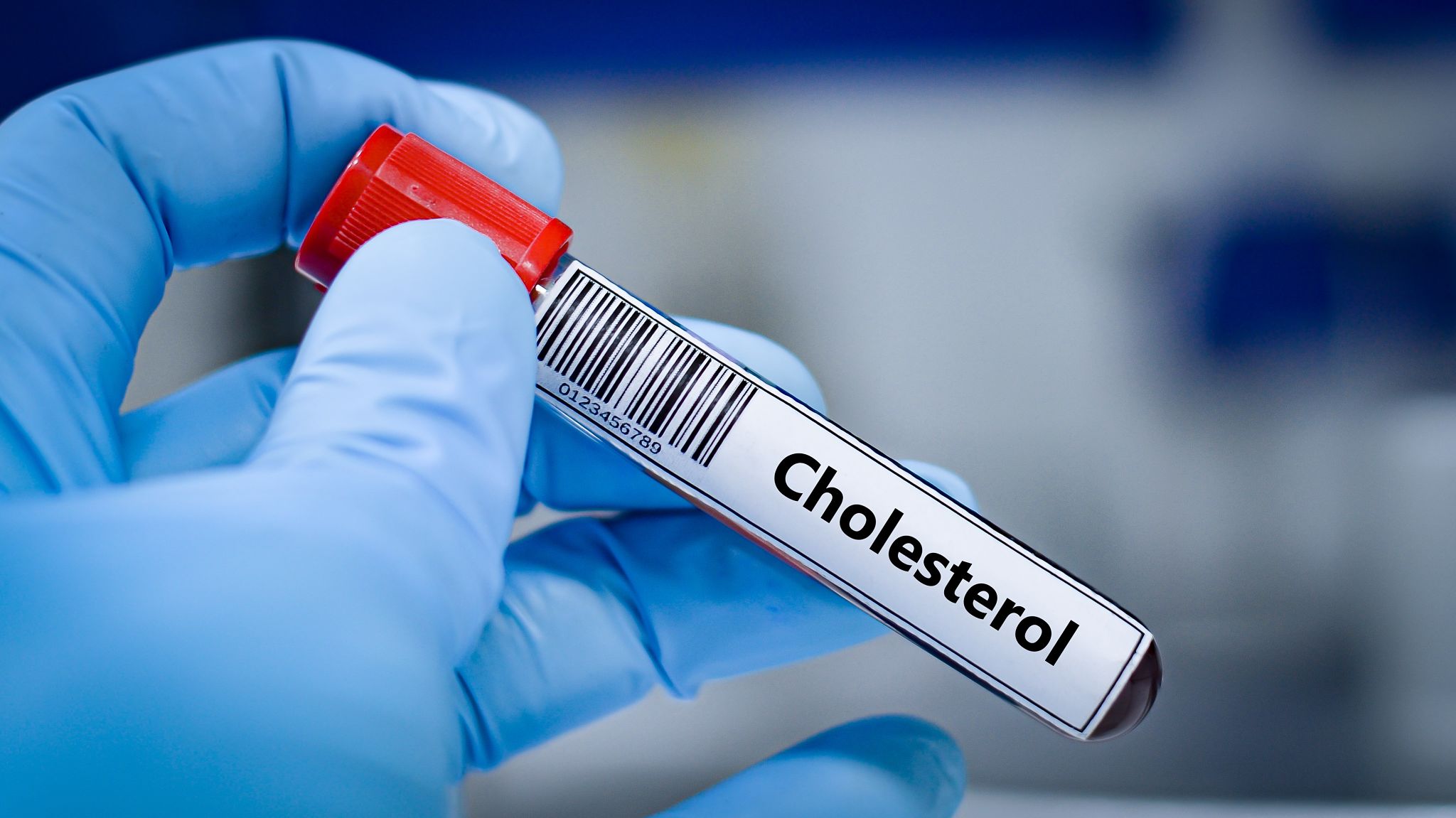cholesterol test
