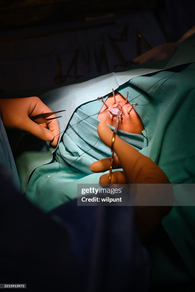 Eye surgery for cancer treatment performed by skilled medical professionals