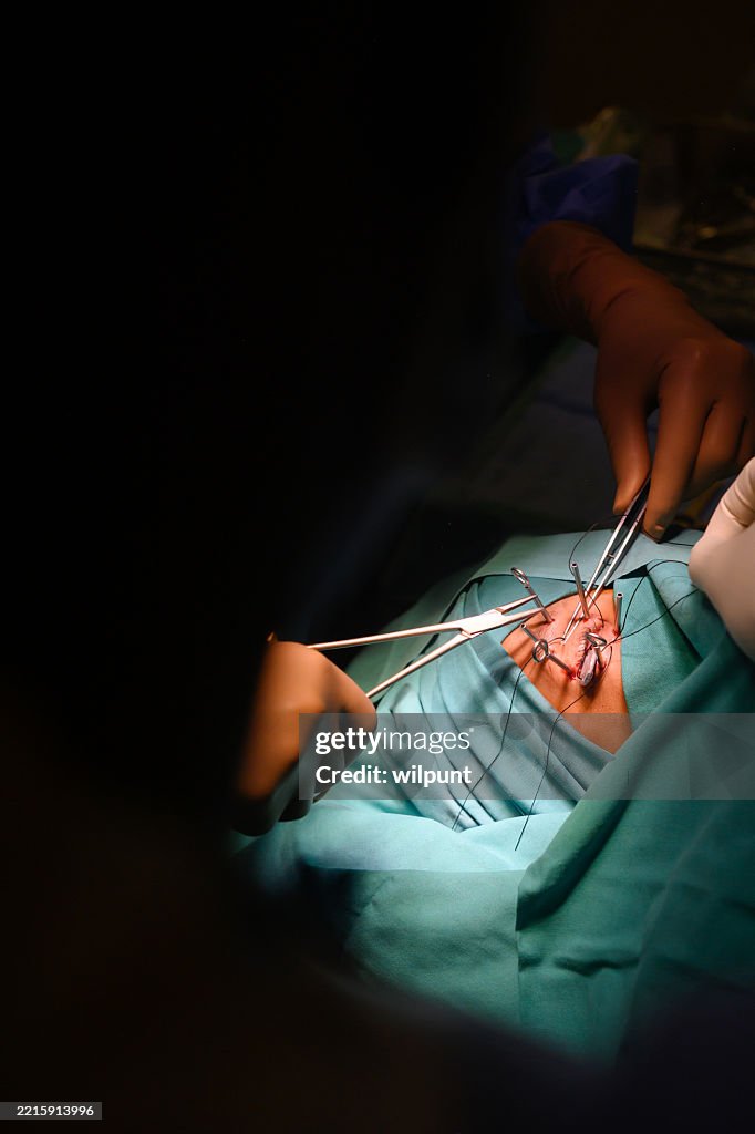 Surgeon meticulously performing cancer-related eye procedure in a specialized hospital