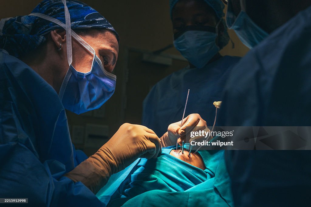 Medical professionals performing intricate Ophthalmic surgery or Ocular surgery in a hospital operating room