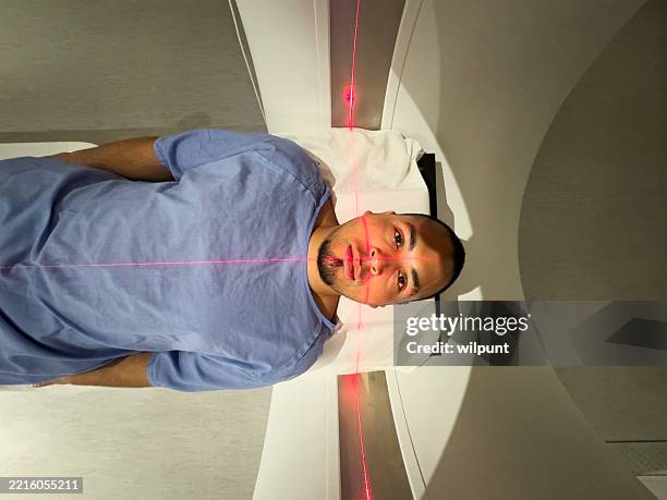 uomo sottoposto a seduta di radioterapia con guida laser in unità di oncologia - personalizzazione foto e immagini stock