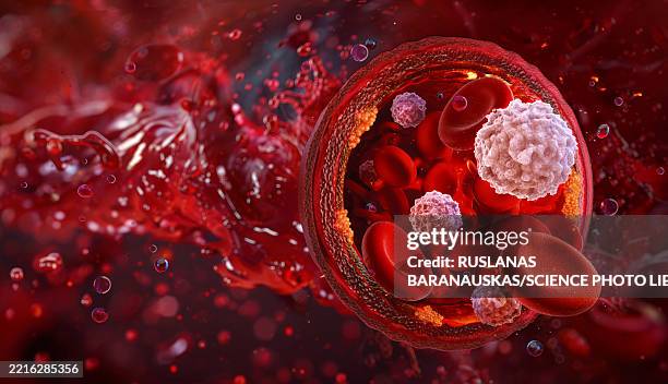 leucocytosis, illustration - human blood stock illustrations