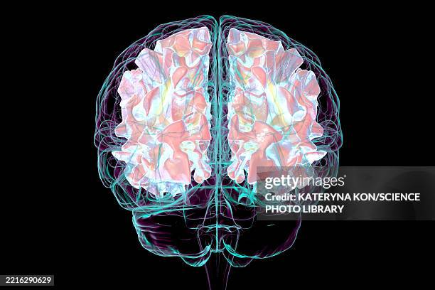 human brain with white matter, illustration - multiple sclerosis stock illustrations