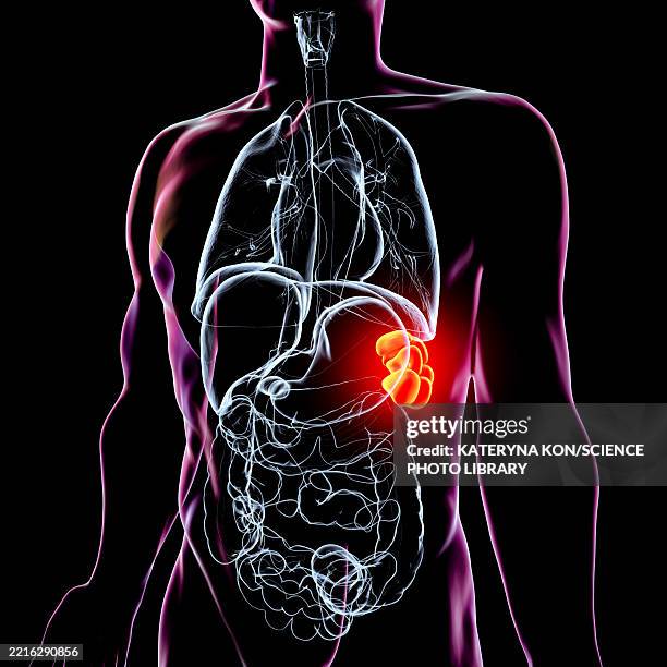 polysplenia, illustration - spleen stock illustrations