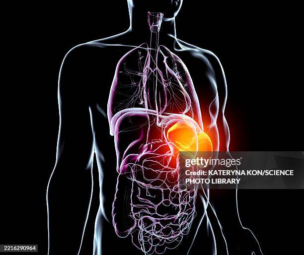 splenomegaly, illustration - spleen stock illustrations