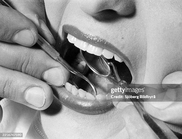 At the dentist. A woman is being treated for plaque and tartar by a dentist. 1940s-1950s