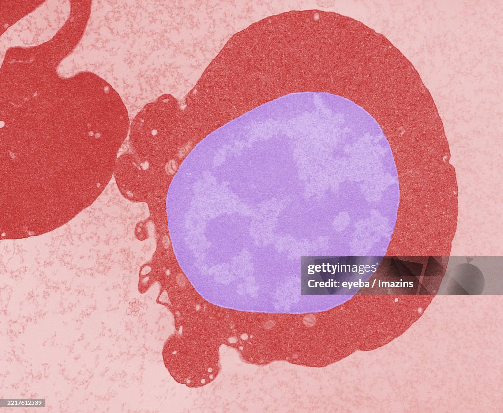 Imtamure Rbc Nucleated Red Blood Cells Immature Red Blood Cells Hematopoietic Stem ...