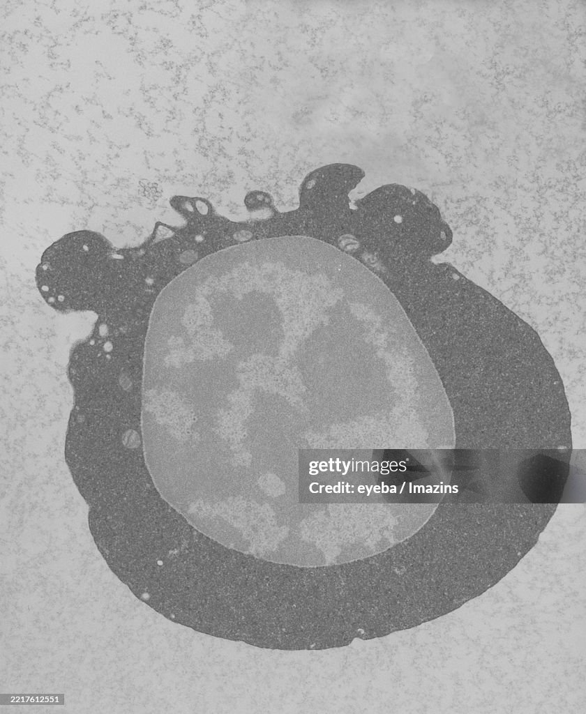 Imtamure Rbc Nucleated Red Blood Cells Immature Red Blood Cells Hematopoietic Stem ...
