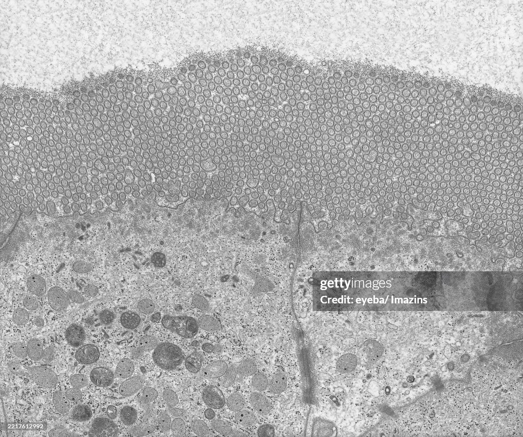 Microvilli of duodenum