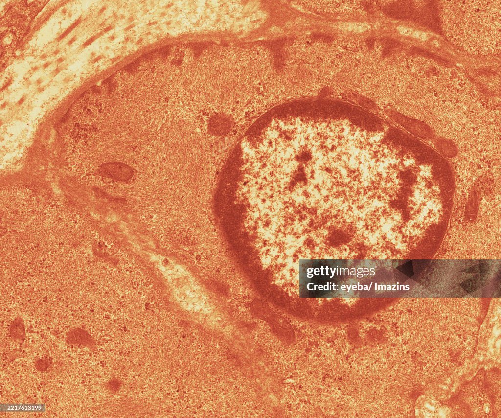 Smooth muscle of artery