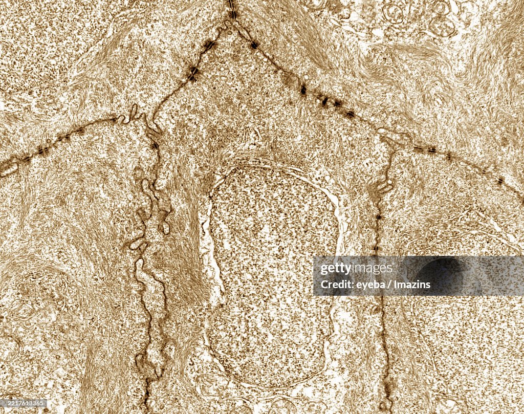 Epithelial cell border and adherens lamina