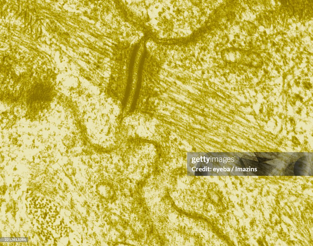 Epithelial cell border and adherens lamina