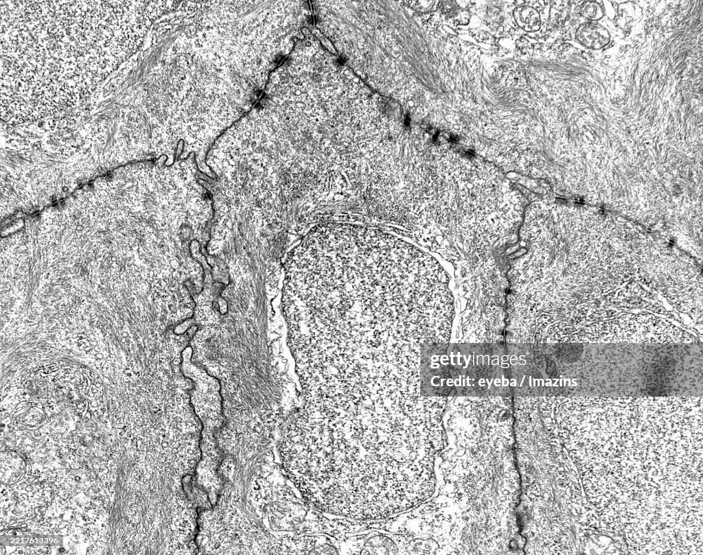Epithelial cell border and adherens lamina
