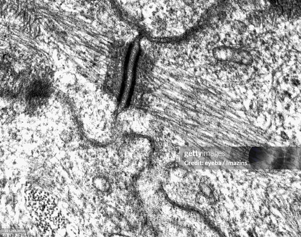 Epithelial cell border and adherens lamina